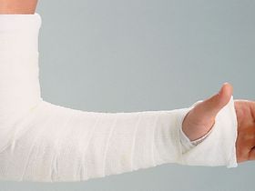 Arm im Gips