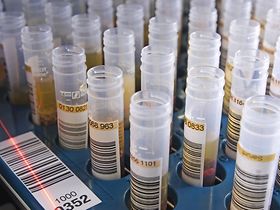 Blutprobenroehrchen in Medizinlabor