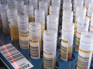 Vaterschaftstest - wann besteht Kostenpflicht der Mutter 