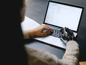 Frau mit künstlicher Hand am Laptop