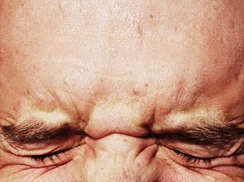 geschlossene Augen auf der Stirn zukneifen