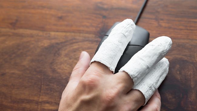 Hand mit Gips an der Maus