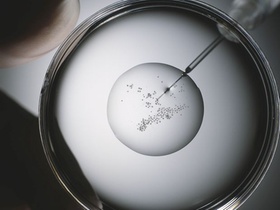 Kuenstliche Befruchtung von Eizellen im Labor