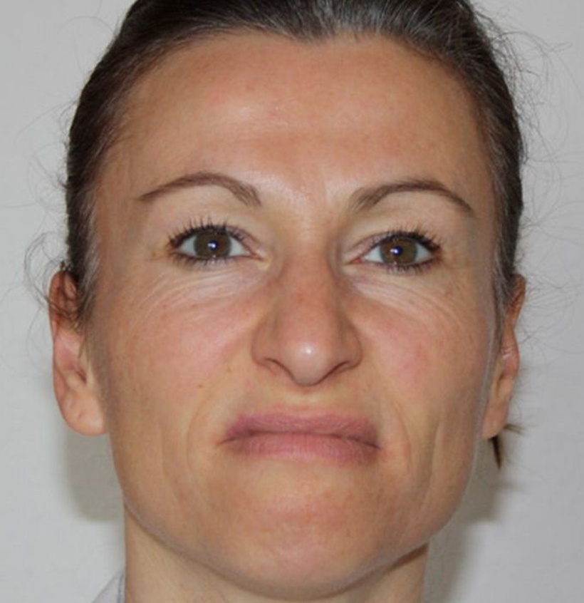 Micro Expression: Ekel