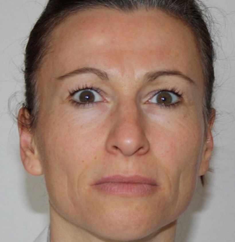 Micro Expressions: Ärger