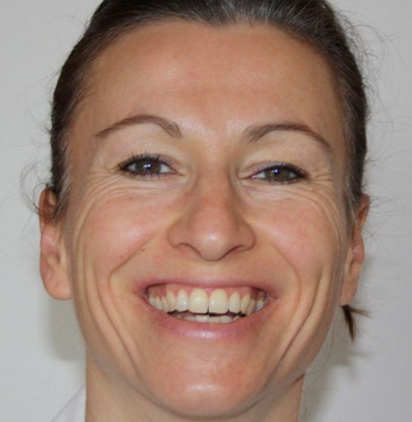 Micro Expressions: Freude