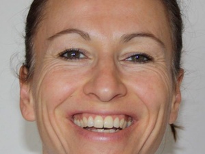 Diagnostik: Wie Micro Expressions die Personalauswahl erleichtern