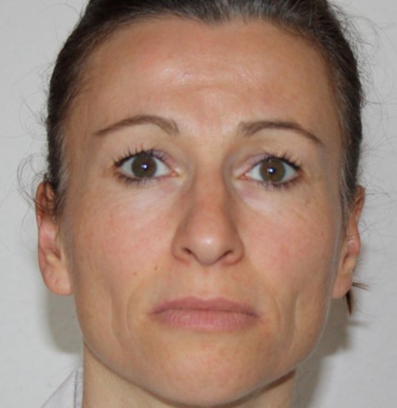 Micro Expressions: Traurigkeit