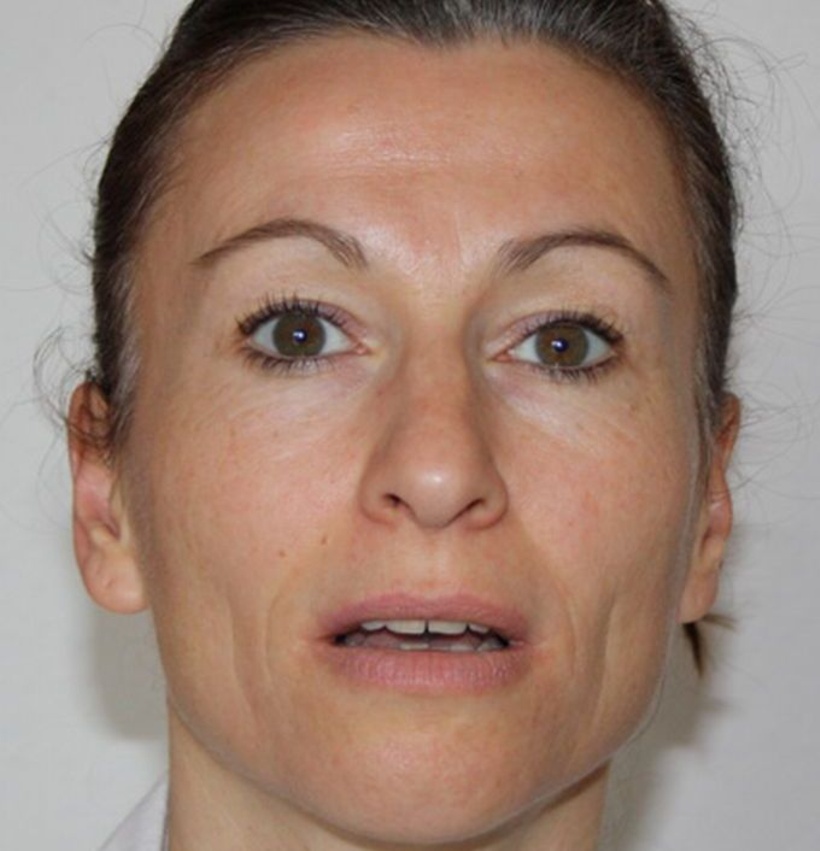 Micro Expressions: Überraschung