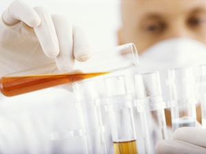 Vergütung für Arbeitnehmererfindung kein begünstigter Arbeitslohn