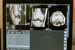 Röntgen knie