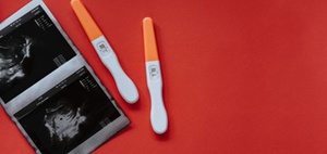 Mutterschutz: Freistellung von Schwangeren für Untersuchungen